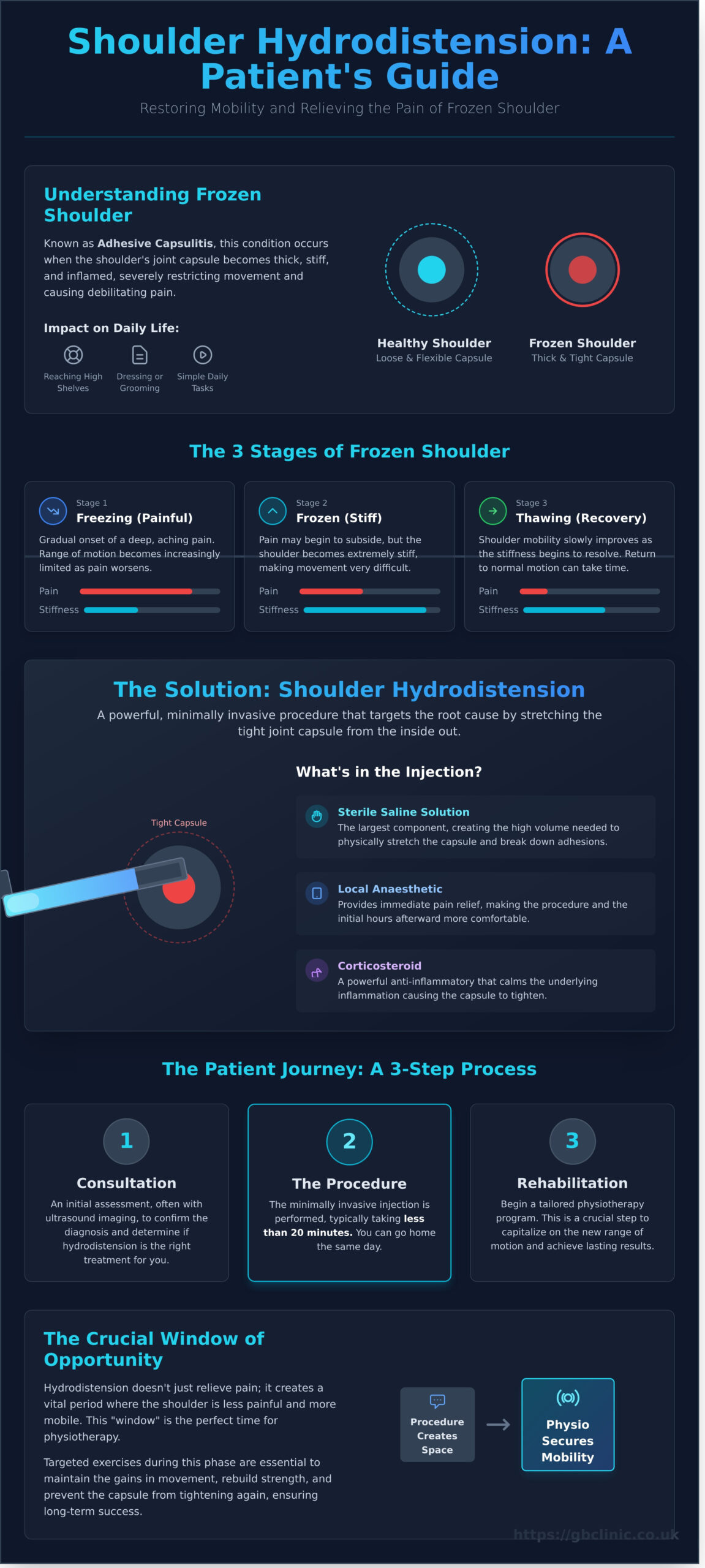 Shoulder Hydrodistension for Frozen Shoulder: A Patient’s Guide - Infographic